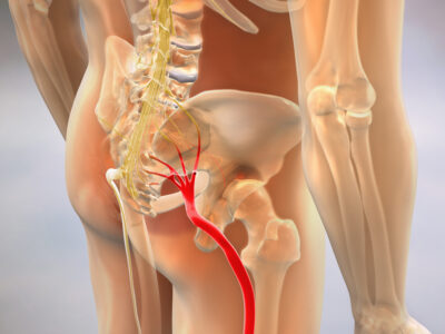 Sciatic-Nerve